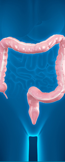 Benign Colorectal